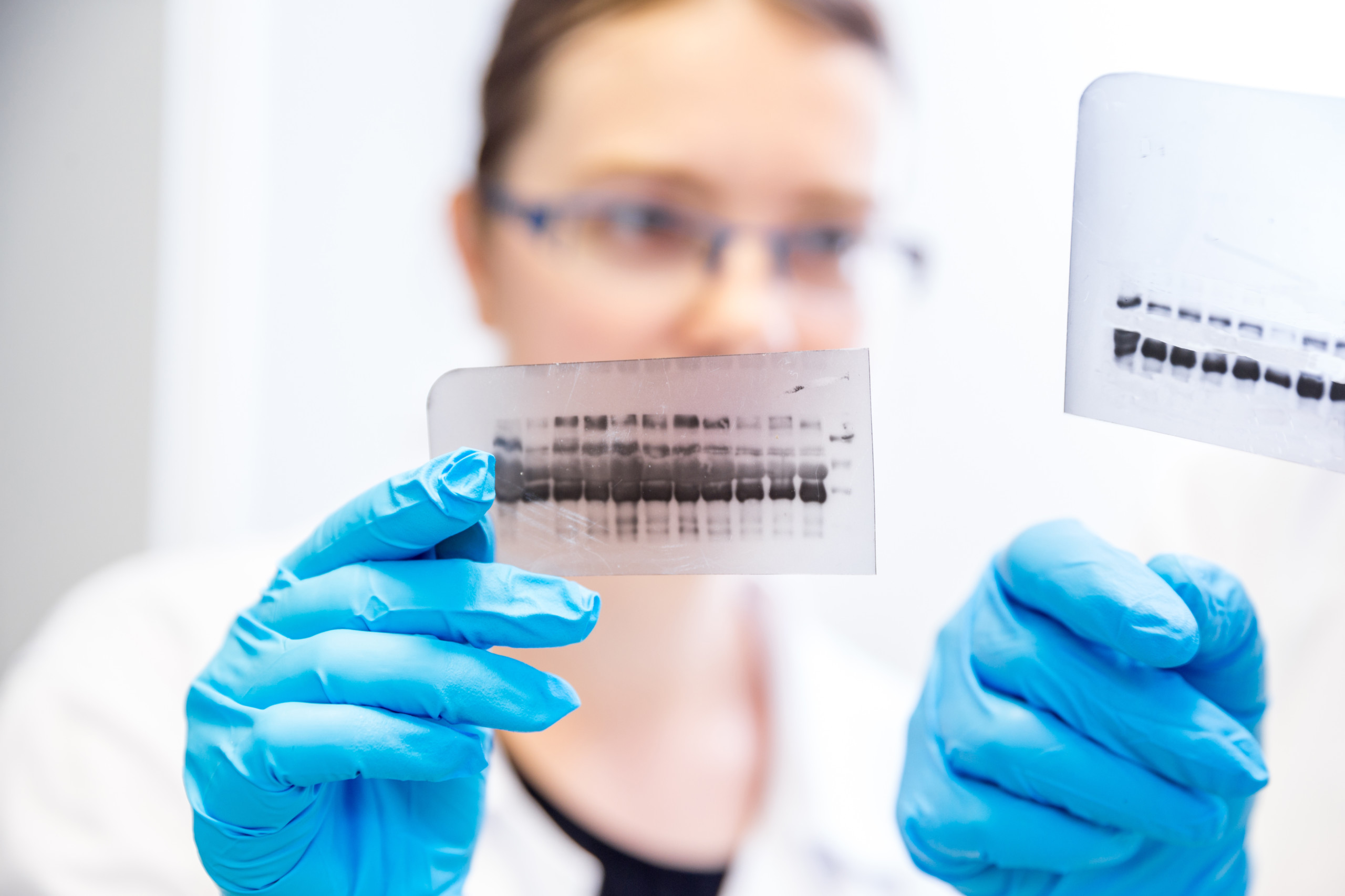 Western Blotting Is A Very Reliable Method For Protein Identification 